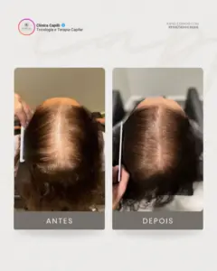 Tricologista